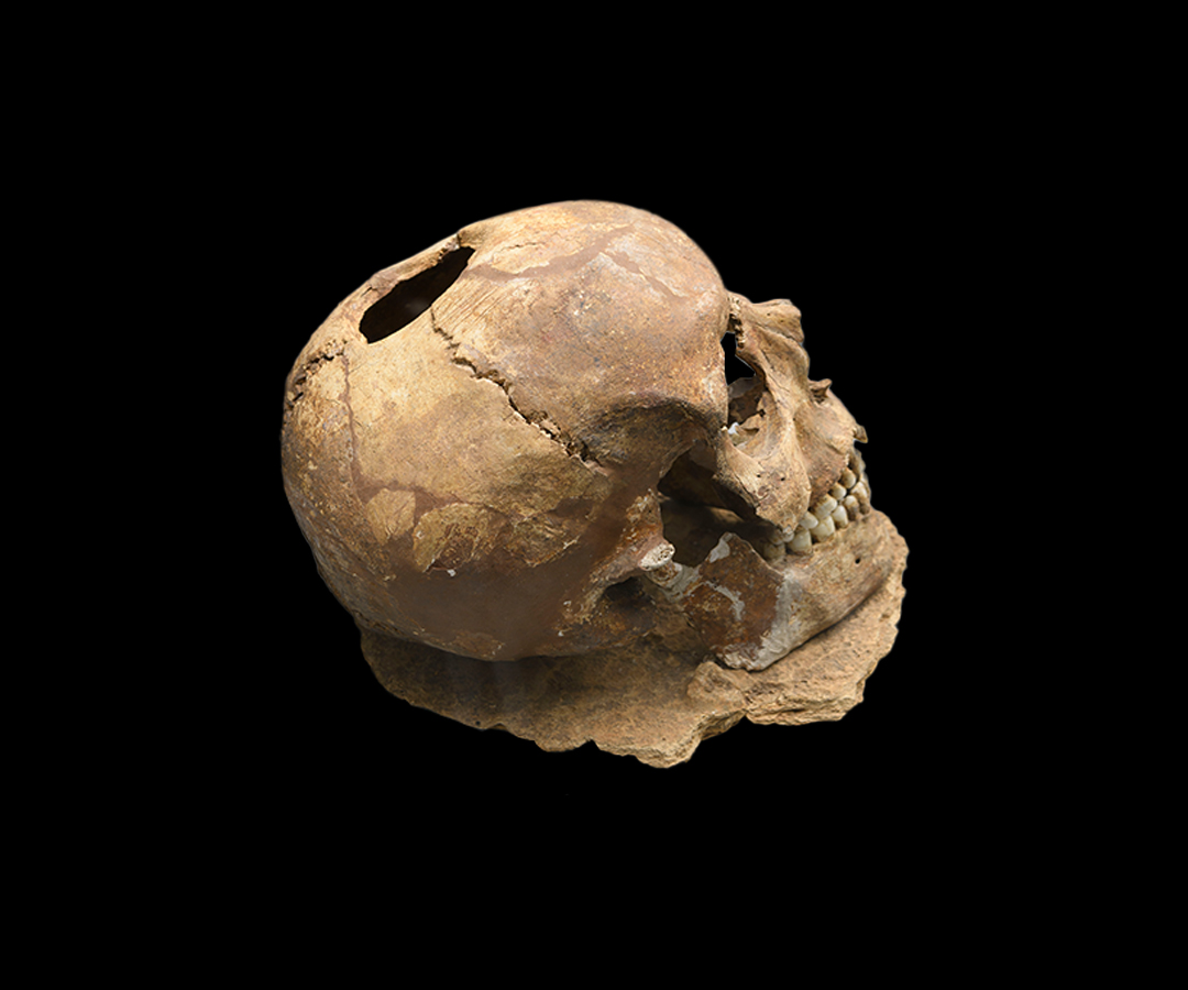 Cranio umano trapanato grotta patrizi_mpe101236